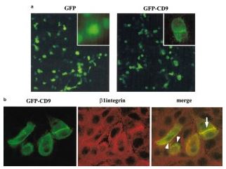 小細胞肺癌SCLCの分子標的薬の治療について