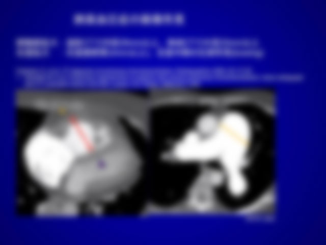 阪大呼吸器内科外科の先生方主催のカンファレンス