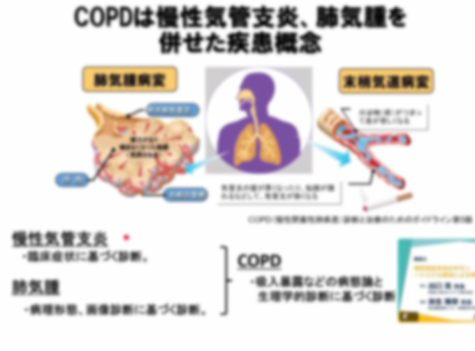 慢性気管支炎のギモン〜トリプル療法による早期治療介入の重要性